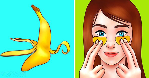 Vỏ Chuối Làm Giảm Quầng Thâm Và Bọng Mắt